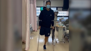 Christopher Won, a Vancouver firefighter, is seen in the hospital in Hong Kong after having his leg amputated. (Submitted)