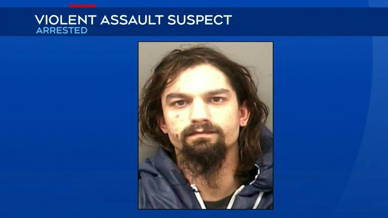 Man charged for violent assault