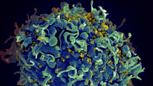 FILE - This electron microscope image made available by the U.S. National Institutes of Health shows a human T cell, in blue, under attack by HIV, in yellow, the virus that causes AIDS. (Seth Pincus, Elizabeth Fischer, Austin Athman/National Institute of Allergy and Infectious Diseases/NIH via AP, File)