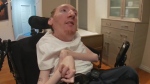 A man living with a rare and debilitating disease 