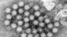 Norovirus spreads easily and quickly through particles from an infected person's feces or vomit. (AP)
