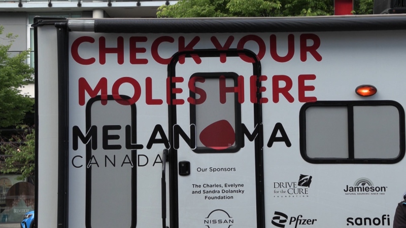Melanoma Canada launched the Mole Mobile in Vancouver on May 8, 2024. Physical exams were scrapped in B.C. on May 13 and replaced by verbal risk assessments due to a difficult in recruiting dermatologists. 