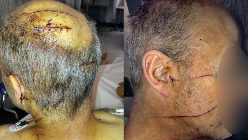 A 55-year-old man was attacked while walking his dog on the morning of May 5, 2024. (Supplied)