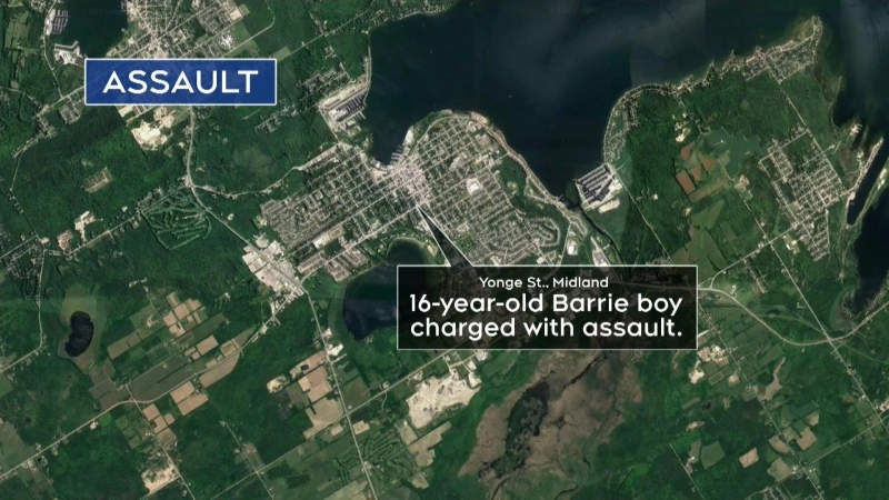 Barrie boy faces serious assault charge