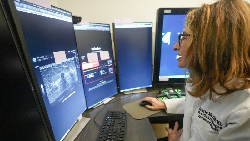 Dr. Laurie Margolies demonstrates the Koios DS Smart Ultrasound software, Wednesday, May 8, 2024, at Mount Sinai hospital in New York. (Mary Altaffer / The Associated Press)