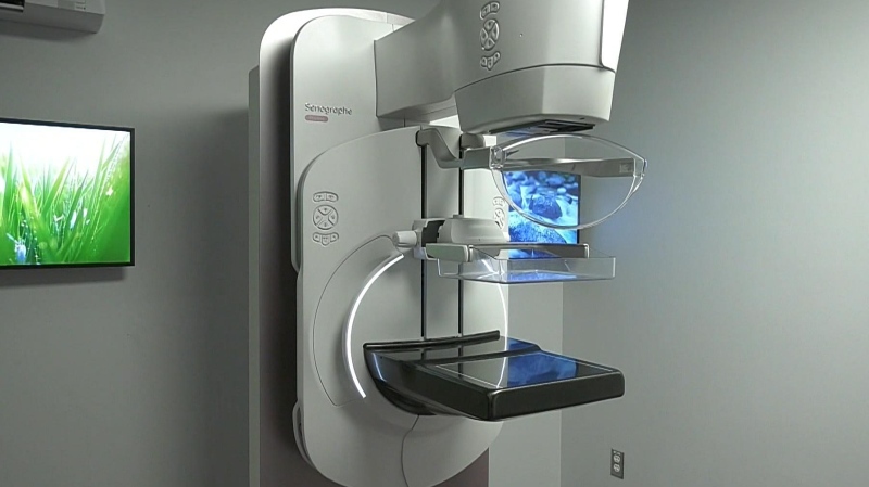 Mammography machine at ESHC