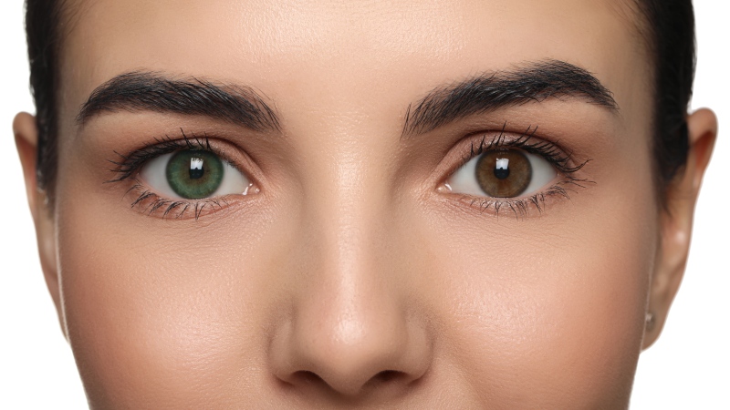 A woman with two different coloured eyes is seen in this undated stock image. (Shutterstock)