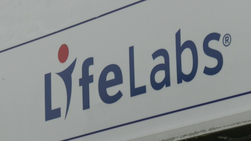 LifeLabs workers vote to ratify deal