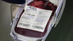 Donated blood fills into a collection bag aboard a OneBlood blood donation bus, Wednesday, April 22, 2020, in Miami. Due to the COVID-19 pandemic, thousands of blood donation sites have been closed and the need for blood is now critical. (AP Photo/Wilfredo Lee)