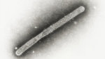 This 2005 electron microscope image shows an avian influenza A H5N1 virion. (Cynthia Goldsmith, Jackie Katz / CDC via AP)