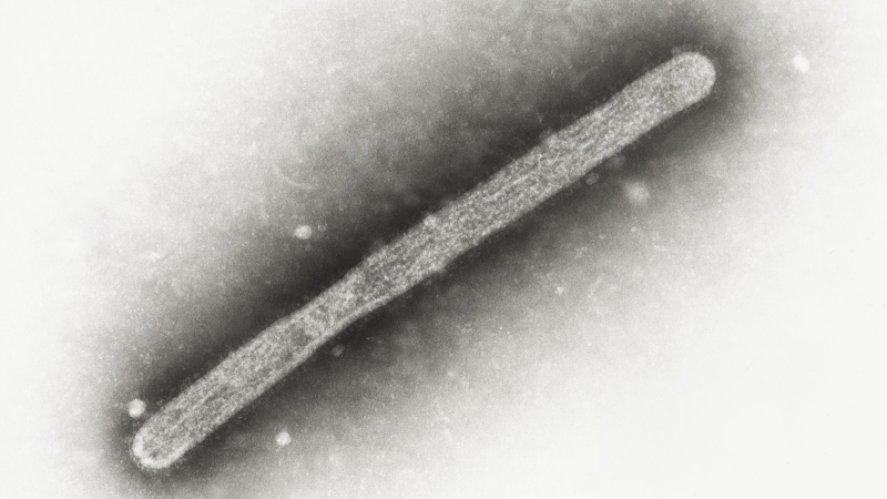 This 2005 electron microscope image shows an avian influenza A H5N1 virion. (Cynthia Goldsmith, Jackie Katz / CDC via AP)