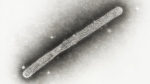 This 2005 electron microscope image shows an avian influenza A H5N1 virion. (Cynthia Goldsmith, Jackie Katz/CDC via AP)