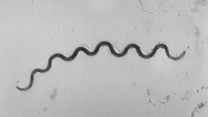 This 1972 microscope image provided by the Centers for Disease Control and Prevention shows a Treponema pallidum bacterium which causes the disease syphilis. (Susan Lindsley / CDC via AP)