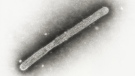 This 2005 electron microscope image shows an avian influenza A H5N1 virion. (Cynthia Goldsmith, Jackie Katz/CDC)