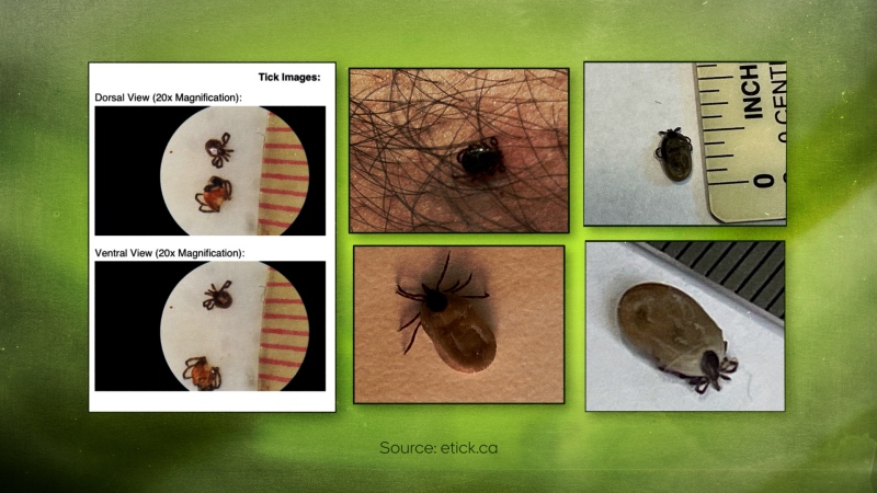 A collage of blacklegged ticks. (Courtesy: etick.ca)