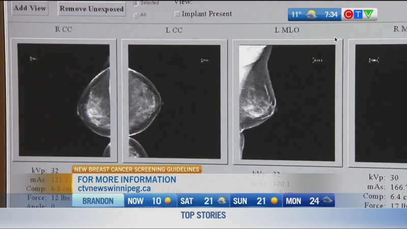 Calls to change breast screening practices