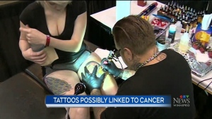 Tattoos and a link to cancer
