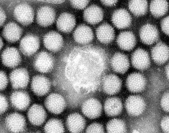 Вирус гриппа под. Аденовирус в клетках hela. Вирус гриппа под микроскопом. Аденовирус в микроскопе.