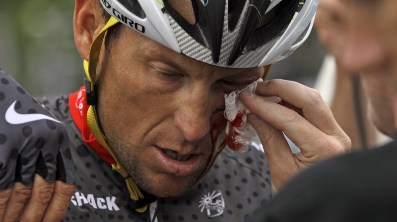 Lance Armstrong is tended to after crashing during the fifth stage of the Tour of California cycling race in the outskirts of Visalia, Calif., Thursday, May 20, 2010. (AP / Marcio Jose Sanchez)