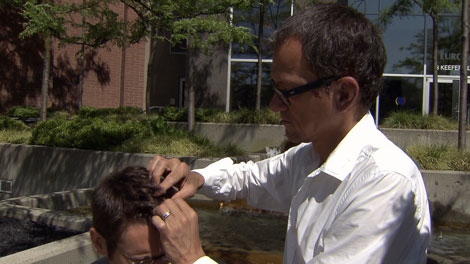 Peter Regier received stitches after being assaulted outside of his apartment on June 12, 2010. (CTV)