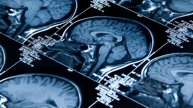 New online 'brain checkup' promises to assess health of user's memory