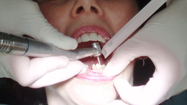 B.C. woman wins $15K in damages for 'serious pain and suffering' caused by dentist  image