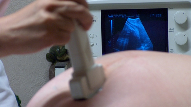 Woman Has Ultrasound Test