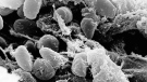 Undated handout image provided by Rocky Mountain Laboratories showing an electron micrograph depicting a mass of Yersinia pestis bacteria -- the cause of bubonic plague. (AP Photo/Rocky Mountain Laboratories)