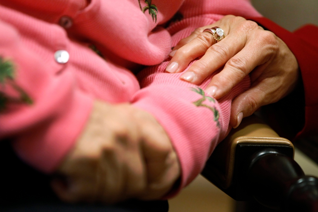 Alzheimer's disease numbers will jump by 2050