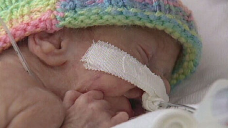 Surrey Memorial Hospital has quietly downgraded four beds used to care for premature babies. Aug. 2, 2010. (CTV)