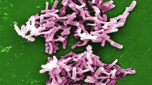 Fake stool could be used to treat C. difficile