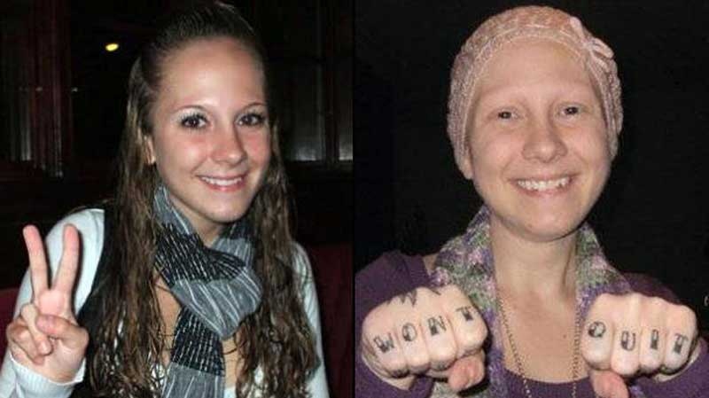In this undated photo, Ashley Kirilow is seen with and without hair. The photo was posted to a Facebook group called "Change" For a Cure. Kirilow is listed as one of the group's administrators.