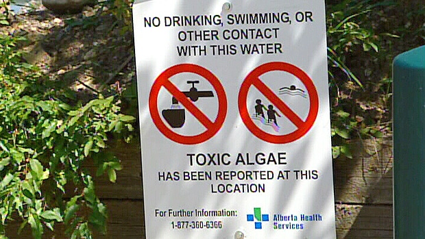 Signs have been posted around Pigeon Lake, south west of Edmonton, warning residents and visitors to avoid the water, due to a blue-green algae advisory. Monday, July 30.