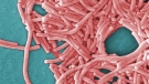 A large grouping of Gram-negative Legionella pneumophila bacteria are shown in this colorized 8000X electron micrograph image from 2009. (AP / Janice Haney Carr)