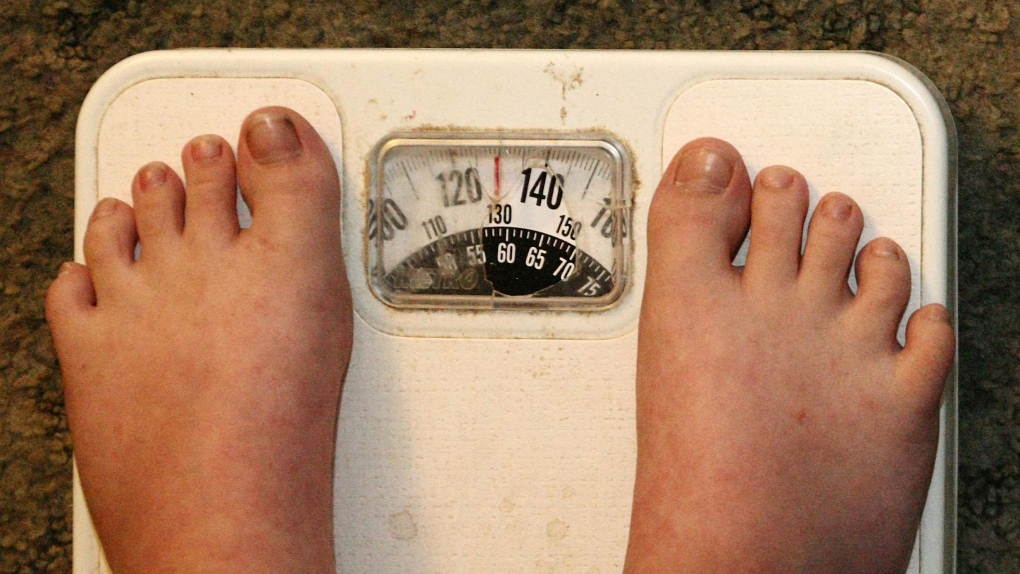 Obesity, Scale, Weight, 