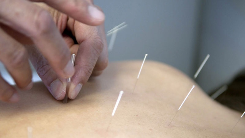 Acupuncture and Alexander Technique may improve neck pain