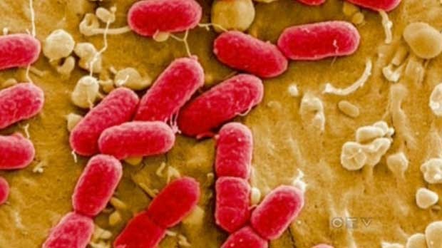 Ontario E.coli cases linked to Maritime cases