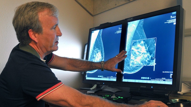 Radiologist Dr. Paul Bice compares an image from earlier, 2-D technology mammogram to the new 3-D Digital Breast Tomosynthesis mammography Tuesday, July 31, 2012, in Wichita Falls, Texas. (AP Photo/The Wichita Times-Record-News,Torin Halsey)