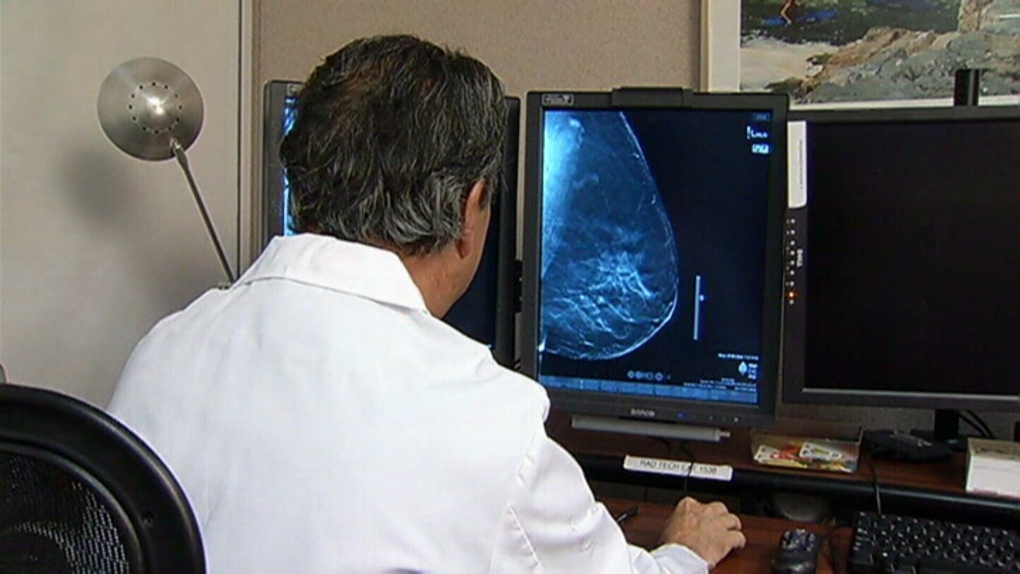New mammogram helping doctors