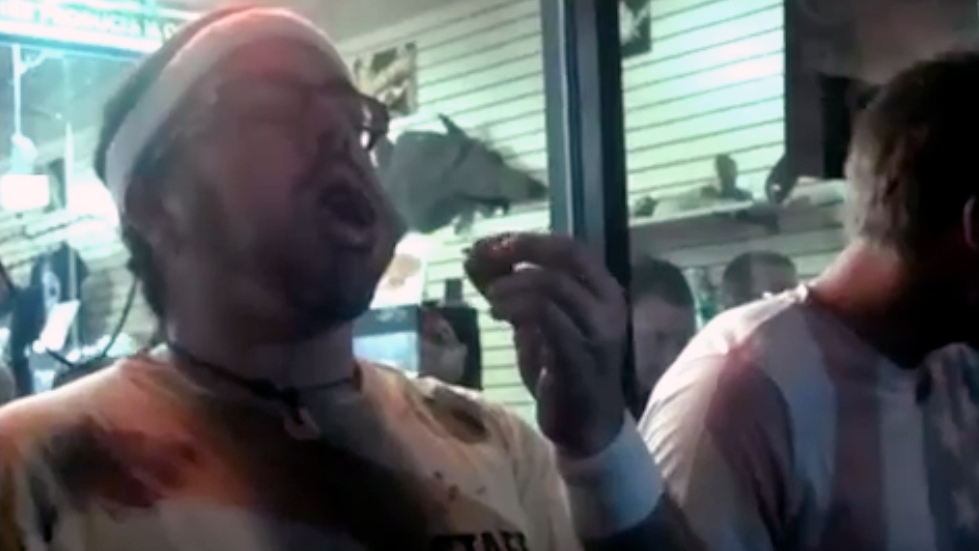 Florida roach-eating contest winner dies