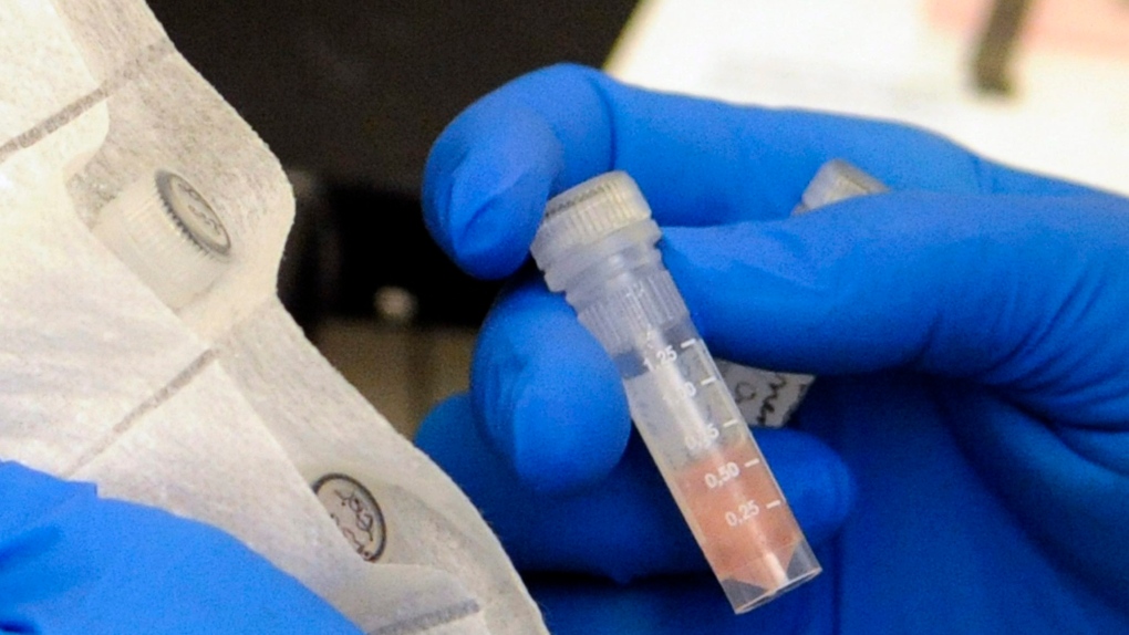 Two more drugs linked to meningitis outbreak
