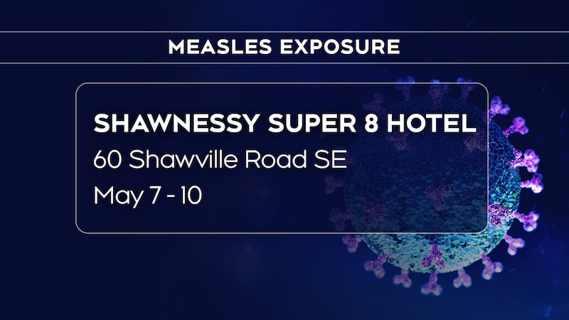 Public alert for measles exposure in Calgary issued by province