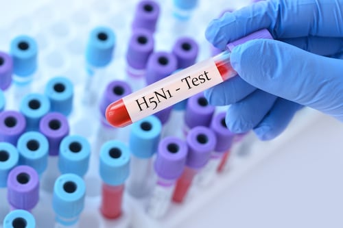 Australia confirms first H5N1 bird flu case in local mammal