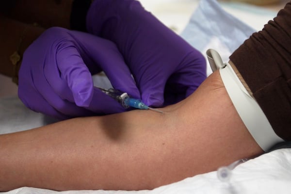 ‘We are going to see serious adverse events’: What are injectable peptides?