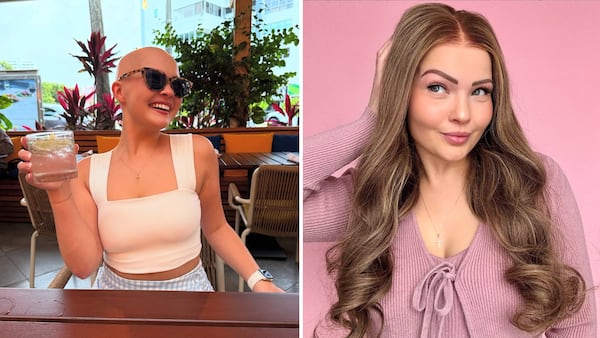 ‘The Art of Alopecia’ creator embraces her ‘best bald life’