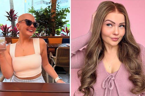 ‘The Art of Alopecia’ creator embraces her ‘best bald life’