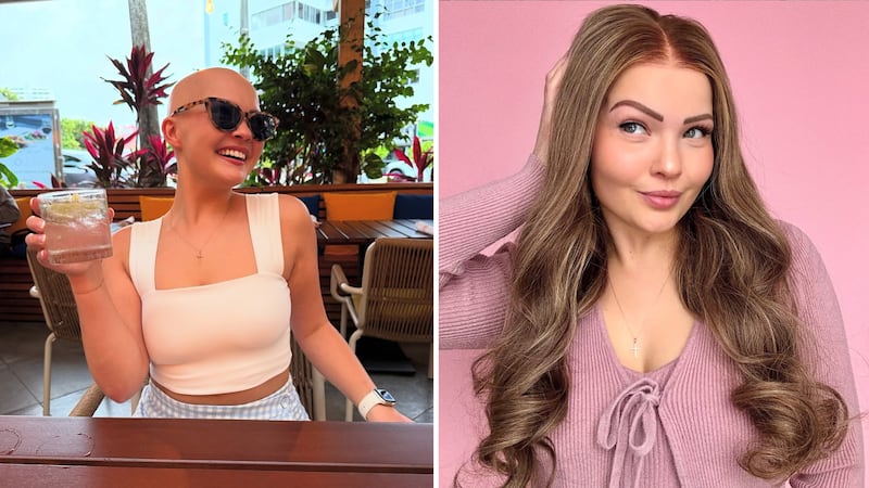 ‘The Art of Alopecia’ creator embraces her ‘best bald life’
