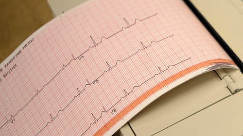 Heart failure rising among younger Canadians, data shows. This cardiologist explains why