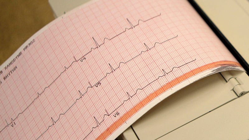 Heart failure rising among younger Canadians, data shows. This cardiologist explains why