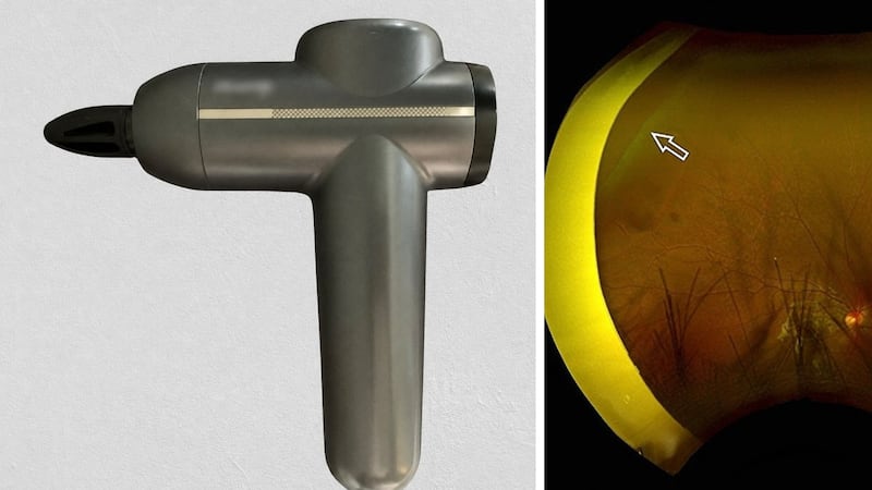 Massage gun use on eyes linked to retinal tears, doctors say